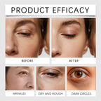 Calcium Skincare Set Anti-Aging Calcium Volume Facial Serum Eye Patches Multi Balm Fade Fine Lines Reduce Dark Circles Nourishes