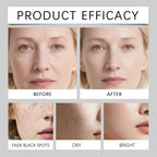 Calcium Skincare Set Anti-Aging Calcium Volume Facial Serum Eye Patches Multi Balm Fade Fine Lines Reduce Dark Circles Nourishes